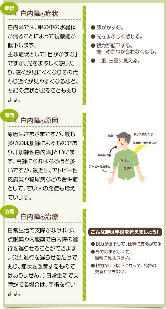 白内障の症状、白内障の原因、白内障の治療についての説明のイラスト